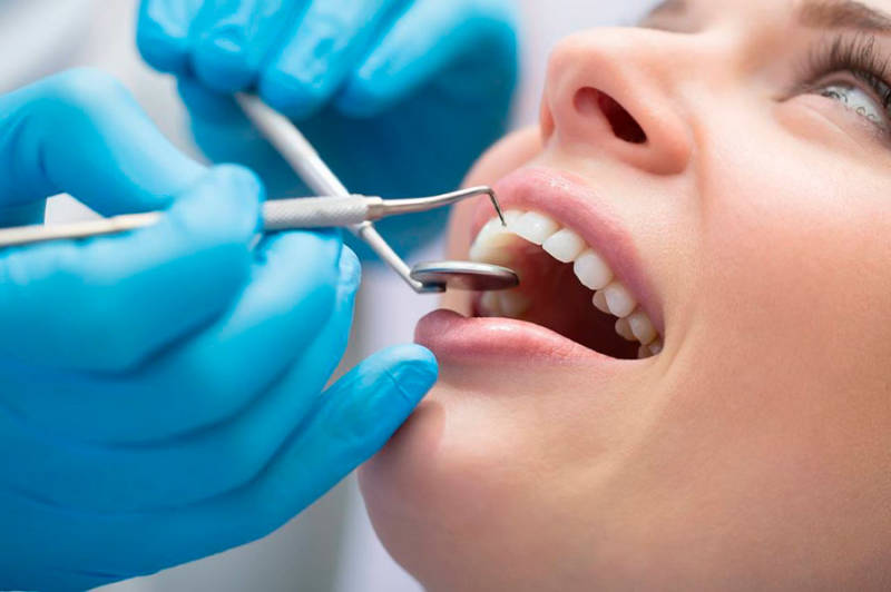 зубы стоматология