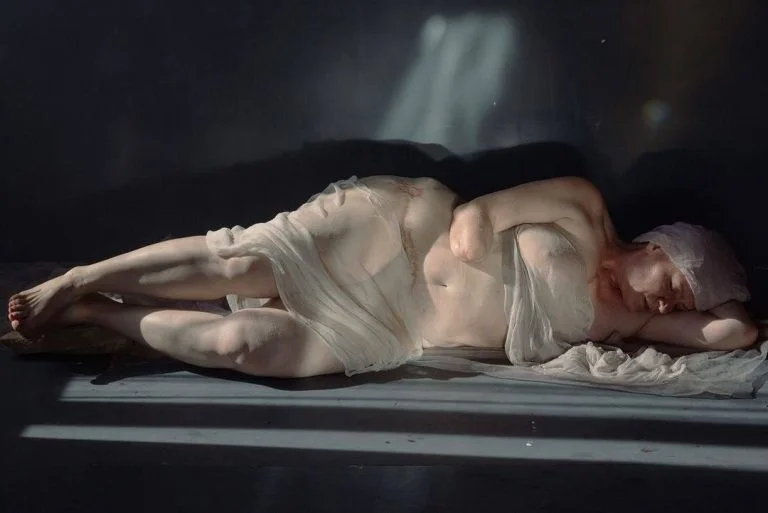 Херсонка, яка втратила кисть внаслідок російського обстрілу, стала героїнею фотопроєкту